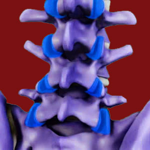 Ankylosing Spondylitis Facet Joints