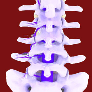 causes of facet joint pain