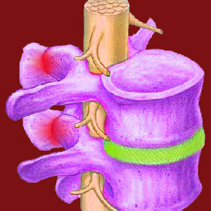 chronic facet joint pain