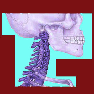 Facet joint dislocation