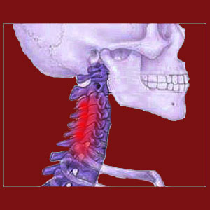 Facet joint neck pain