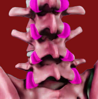 Facet Joint Nerve Ablation