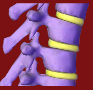 Facet Joint Foraminotomy