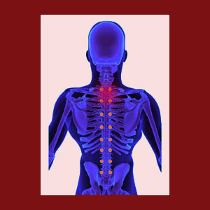 Hypomobile Facet Joint