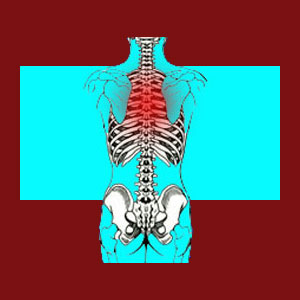 Misdiagnosed facet syndrome