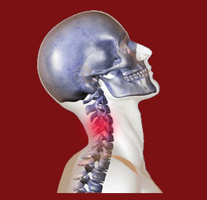 Neck Extension Facet Joint Pain