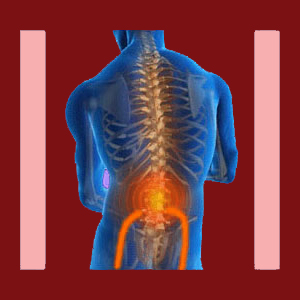 Referred Facet Joint Pain