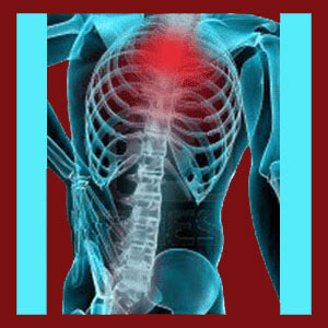 Thoracic facet joint syndrome